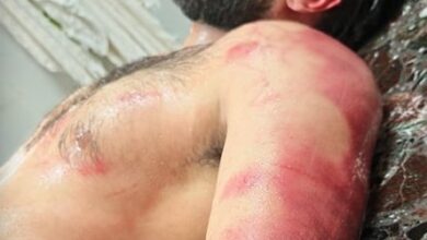 توثيق حقوقي: تزايد المؤشرات على تدهور خطير بأوضاع حقوق الإنسان في البحرين